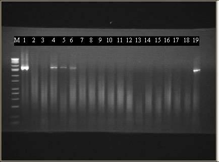 78 Şekil 4.24. Domates Meyvelerinin P1-P7 Universal Primer Seti ile 16S-23S rdna PCR elektroforez sonuçları. M: Marker 1. kuyu: Pozitif Kontrol 2.