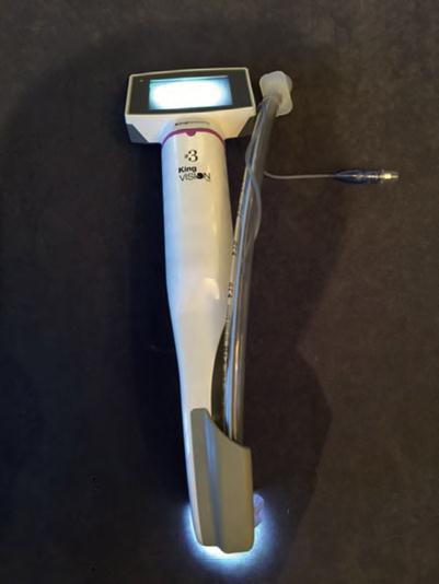 King Vision videolaryngoscope Integrates a single-use, curved video blade attached to a top-mounted display.