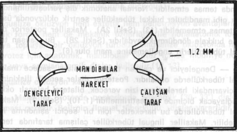 TAM PROTEZLER İÇİN LİNGUALİZE OKLÜZYON ŞEKİL 2A: Geleneksel anatomik posterior oklüzal düzenlemelerde mandibuler bukkal tüberküller maksiller santral fossalarda ve maksiller lingual