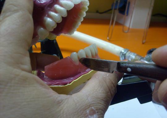 Birinci premolar diģin santral oluğundan geçen çizginin kanin tepesinden geçen çizginin devamında olmasına dikkat ediniz. Resim 2.