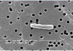 Günümüzde Salmonella lardan kaynaklanan gıda infeksiyonları, ABD, Almanya, Fransa, İngiltere, Galler, İspanya, Hollanda, Polonya ve İsveç te tüm gıda infeksiyon ve intoksikasyonları içerisinde ya ilk