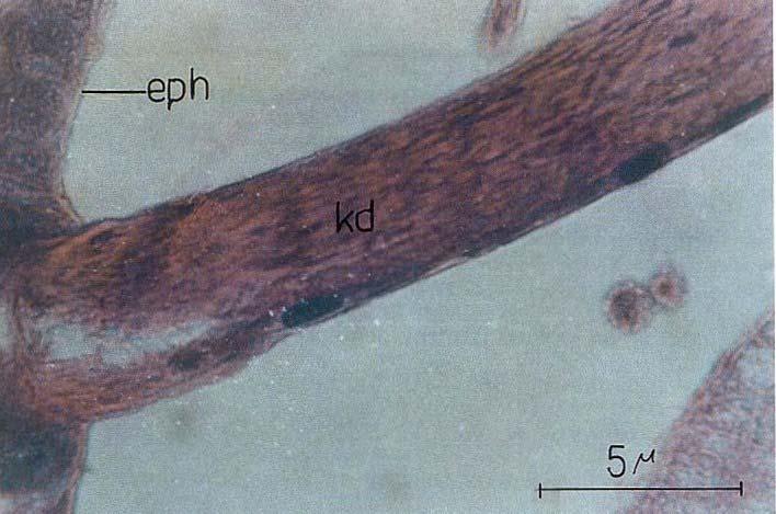 21 Epidermis tabakası larvanın gelişim durumuna göre geniş ve yassı şekilden, kübik ve prizmatik şekle değişebilen hücrelerden oluşmuştur. Epidermis tabakası kas ve yağ doku ile kısmi bağlantılıdır.