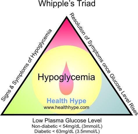 Diyabetik Aciller :HİPOGLİSEMİ Hipoglisemi var diyebilmek için (WHİPPLE TRİADI): 1) Semptomların olması 2)