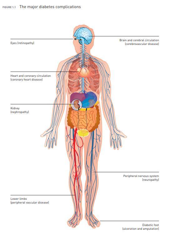 Diyabetin başlıca kronik komplikasyonları Cardiovascular