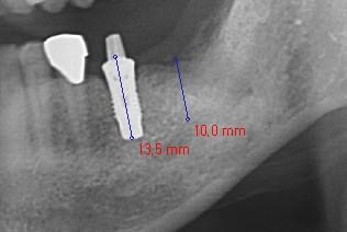 1. Computed Tomography 1-5.