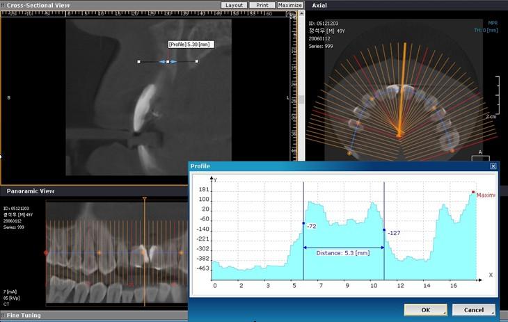 1. Computed Tomography 1-5.