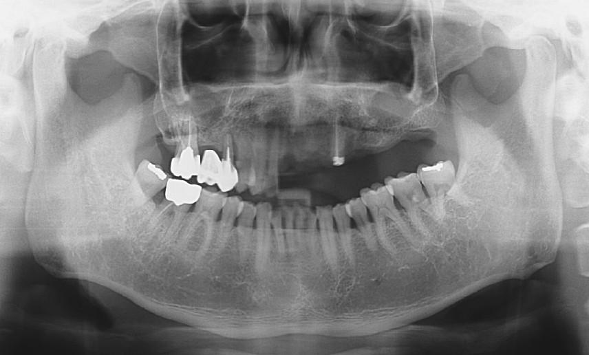 3. Klinik vakalar Case 1.