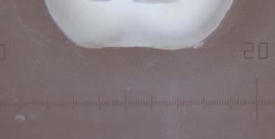 Elde edilen bu değer (mm/dk) cam mikropipetin çapı olan 0, 38 sabit değeri ile çarpılarak birimi µl ye çevrildi.