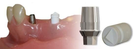 DYNA PROTEZ TiBase abutment Tarama gereksinimi olan abutment sistemlerinde zirkonyum kaplanabilir, Sirona Dental Cerec sistemine dayalı abutment seçeneğimizdir.