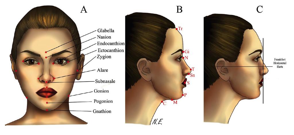 öndeki yumuşak dokudur. Subnasale, kolumella ile üst dudak derisi arasındaki birleşim noktasıdır. Labiale superius (LS), üst dudağın orta sagittal düzlemde mukokutanöz birleşim noktasıdır.