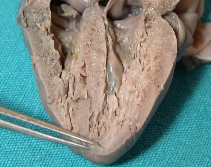 4.5. Atrium-ventrikül boyutları ile ilgili parametreler: Yapılan ventrikül ve atrium kesilerinin ardından, atrium-ventrikül boyutları (Resim 10), kalp kapakçıkları ve kalbe girip çıkan damar