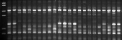 4. BULGULAR ve TARTI MA Serkan AKCAN MA 1 2 3 4 5 6 7 8 9 10 11 12 13 14 15 16 17 18 19 20 21 22 23 ekil 4.9. FidancıA ve FidancıB den alınan 22 adet Kaman-5 çö üründe UBC 814 no lu ISSR primerinin amplifikasyonu.