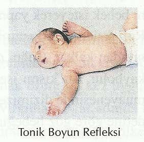 Tonik Boyun Refleksi: Bebek ağlamadığı zamanda, sırt üstü pozisyonda yatarken başını aniden sağa sola