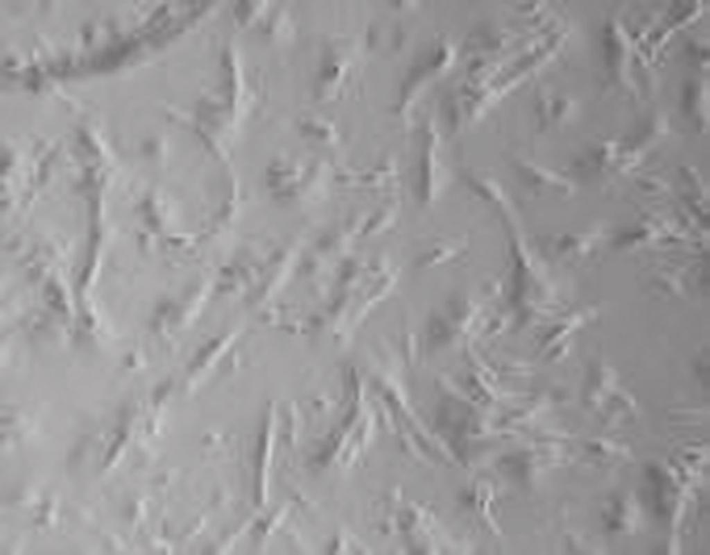 (resim-) (Resim-2) Primer kültüre edilen MNC lerden üretilen mezenkimal hücreler flaskın zeminini kaplayıp confluent yapıya ulaştıktan sonra tripsin-edta ile kaldırılarak yeni bir flaska pasajları