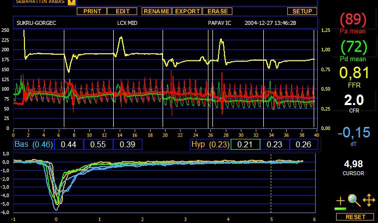 transit süresi / hiperemik