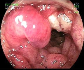 ÜNİVERSİTESİ GASTROENTEROLOJİ Aralık 2006- Eylül 2014 Patolojik