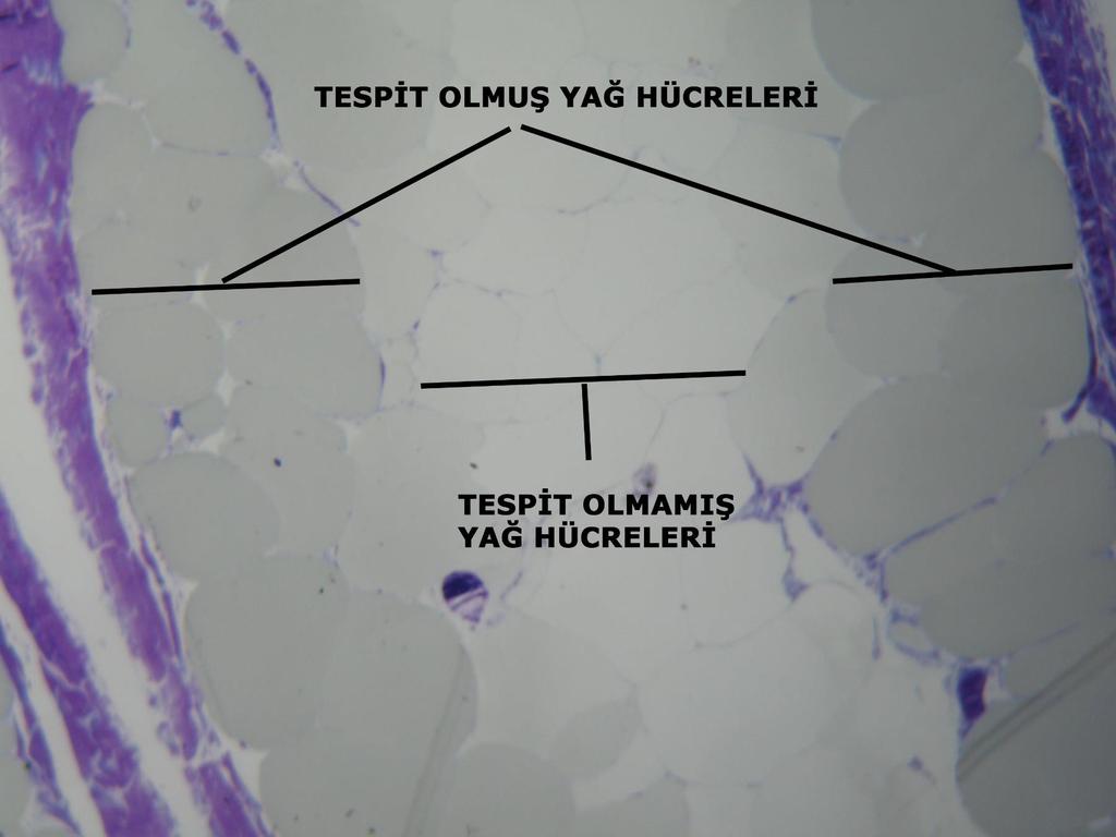 Yağ hücrelerinin sitoplazmasında yağlı maddeler yanında, yağ