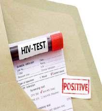 İlk tanı Korku Endişe Sorular HIV enfeksiyonu