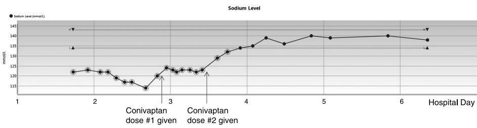 Su Metabolizması 1-Tolvaptan, Conivaptan (ADH antogonisti) Üretici Firma: Otsuka Pharmaceutical Co., Ltd.