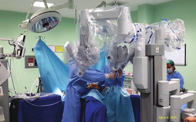 Fasia askı dikişleri ameliyat sırasında trokara tespit edilir ve ameliyat sonunda fasia kapatılırken kullanılacaktır.
