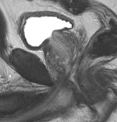 altında kalması bu bölge anatomisinin anlaşılmasını güçleştiren temel faktörlerdir.