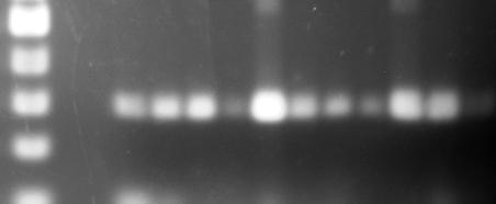 Yapılan PCR amplifikasyonları sonucunda ithal soya ve ithal mısır örneklerinden elde edilen agaroz jellerden görünüm sırasıyla Şekil 4.5 ve Şekil 4.6 da verilmiştir.