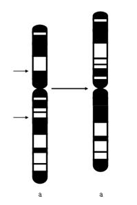 9 numaralı kromozomda gözlenen inversiyon insan