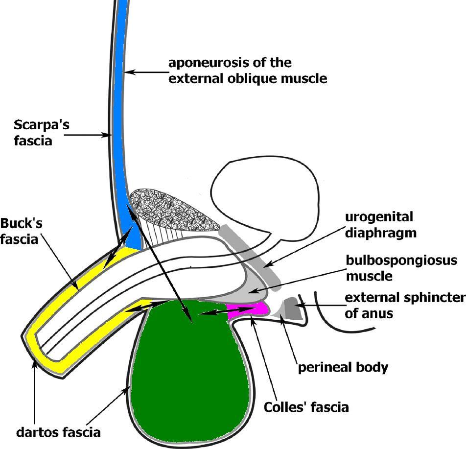 Anatomik potansiyel yayılma yolları -Colles fasyası (perinenin yüzeyel planı) -Dartos
