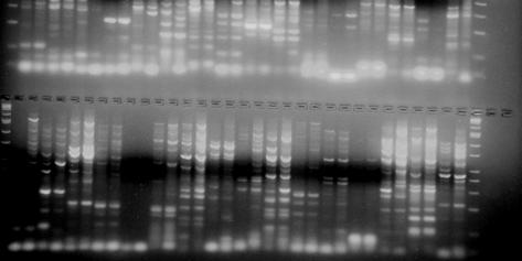 ve reverse) ile SRAP primerleri Em1- Em16 aras kombine edilmi, SRAP PCR artlar kullan lm t r. ekil 4.