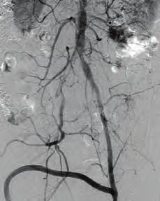 Mitral kapak TEE görüntüsü. Şekil. Hastanın el ve ayaklarındaki konjenital deformiteler. Şekil. Mitral kapak TEE görüntüsü. Şekil 3. Mitral kapak TEE görüntüsü. Kardiyovasküler hemşirelik / Teknisyenlik Şekil.