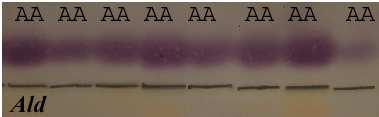 Şekil 4.39 Nişasta jel elektroforezi ile görülen Ald fenotipleri Şekil 4.