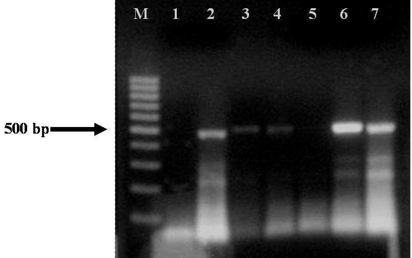 Şekil 4.13. İzolatların RT-PCR sonuçları M.Marker (100 bp DNA Ladder); 1.Su Kontrol; 2.Pozitif Kontrol; 3.Atabey-6; 4.Keçiborlu-8; 5.Ağlasun-3; 6.Karamanlı-3; 7.