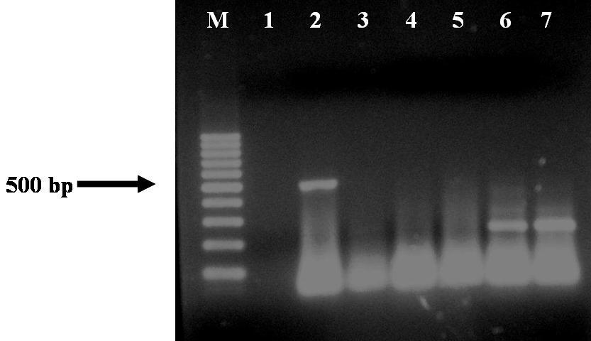 Şekil 4. 15. İzolatların RT-PCR sonuçları M. Marker (100 bp DNA Ladder,); 1.Su Kontrol; 2.