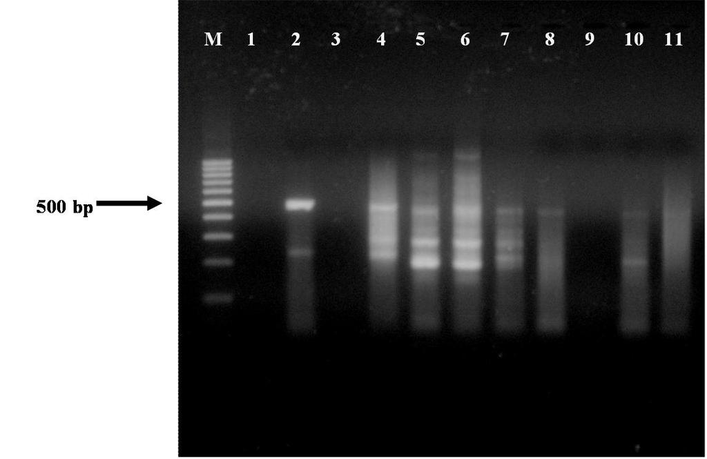 İzolatların RT-PCR sonuçları M. Marker (100 bp DNA Ladder); 1.Su Kontrol; 2.Pozitif Kontrol; 3.