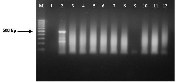 Şekil 4.17. İzolatların RT-PCR sonuçları M. Marker (100 bp DNA Ladder); 1.Su Kontrol; 2.Pozitif Kontrol; 3.Ş. Karaağaç-1; 4.