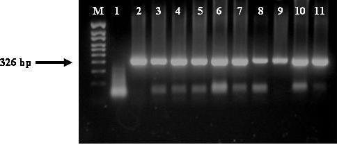 Şekil 4.20. İzolatların Nested-PCR sonuçları M. Marker (100 bp DNA Ladder); 1.Su Kontrol; 2.Pozitif Kontrol; 3.Tefenni-1; 4.Ş.Karaağaç-1; 5.Ş. Karaağaç-4; 6.