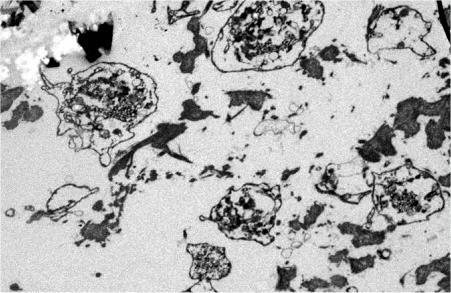 Trombosit granülleri, PDGF Platelet s TGFs