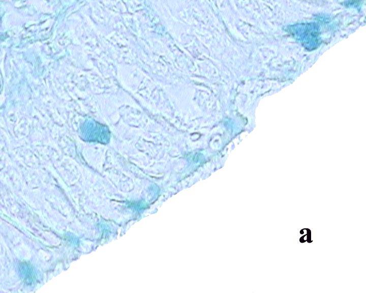 a) bronkusunun goblet hücrelerinde güçlü, serçe (Şekil 4.11.