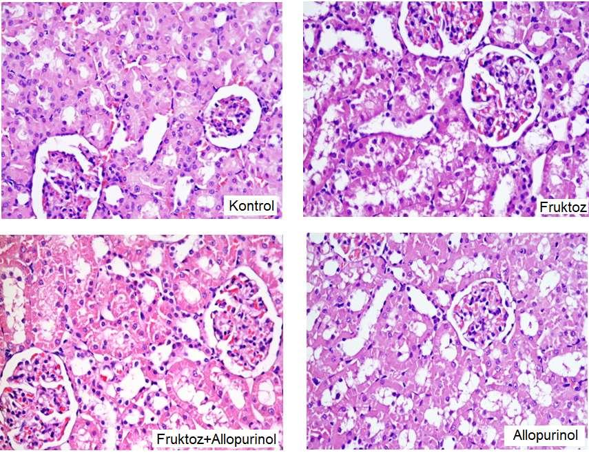 Kontrol: Normal histolojide böbrek dokusu, Fruktoz: Böbrekte tübüler dejenerasyon ve vakuolizasyon,