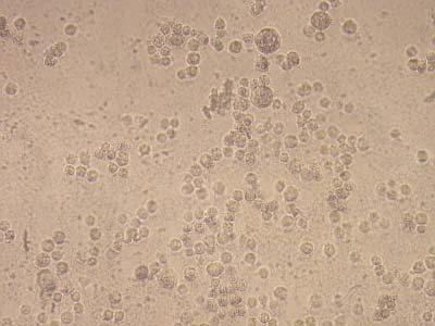 hücrelerinde gözlenen formazon kristalleri (x20) Resim 4.