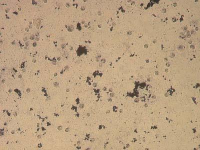 Resim 4.21:1.675 mg/ml Ökse-K uygulamasından72 saat sonra MDA-MB-231 hücrelerinde gözlenen formazon kristalleri (x10) Resim 4.
