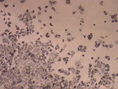MCF-7 hücreleri (x10) Resim 4.