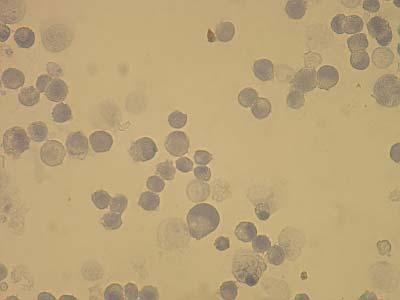 boyanan MCF-7 Hücreleri (20x) Resim 4.100: 1.
