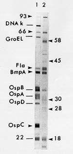 İki aşamalı test EIA veya IFA ile elde edilen seropoziivitenin poziif IgM veya IgG Western immünblot (WB) ile teyit edilmesidir Westernblot yöntemi ile Lyme tanı kriterleri İlk birkaç hata Birkaç