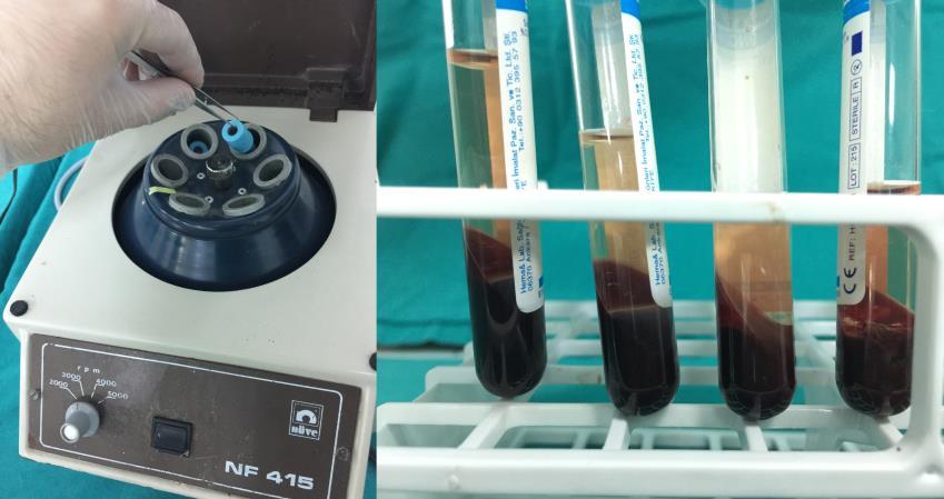 11: Sıçanlardan TZP hazırlanması için intrakardiyak kan alınması Toplanan kan iki aşamalı santrifüj protokolüne uygun şekilde santrifüj için hazırlandı [237].