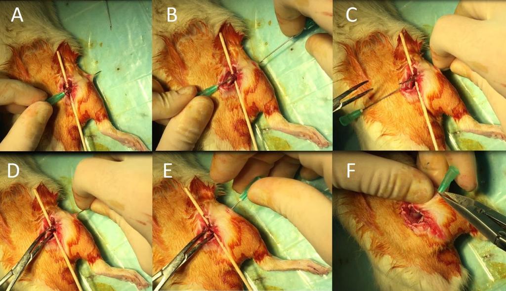 17: Sıçan sağ femur kemiğinin diseksiyonu ve tur aleti ile kemik kırılması sonrası görüntüsü Kırık sonrası kemik stabilitesinin sağlanması için 21 Gauge enjektör iğnesi (Yeşil enjektör, BD Syringe)