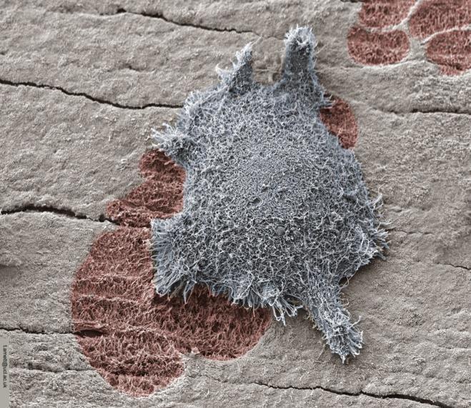 Şekil 2.6: Osteklast hücresinin elektron mikroskopu görüntüsü [39] Kemik remodelingi sırasında osteoklastların polarize olması olmasını takiben 4 tip osteoklast membran alanı ortaya çıkar.