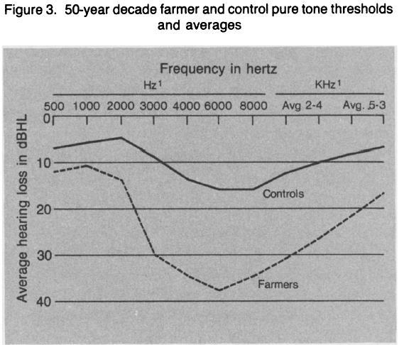 Literatür: Occupational Hearing Loss in Farmers Bruce L. Plakke and Elizabeth Dare; Public Health Reports (1974-), Vol. 107, No. 2 (Mar. - Apr., 1992), pp.