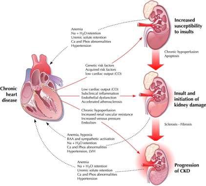 KARDİYO-RENAL SENDROM KRONİK KALP