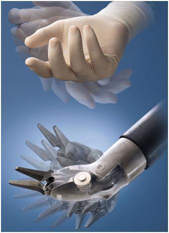Robotik Cerrahinin Avantajları Robot yardımlı ameliyatlardan sonra hastanın hastanede yatış süresi açık ameliyatlara göre kısalır.